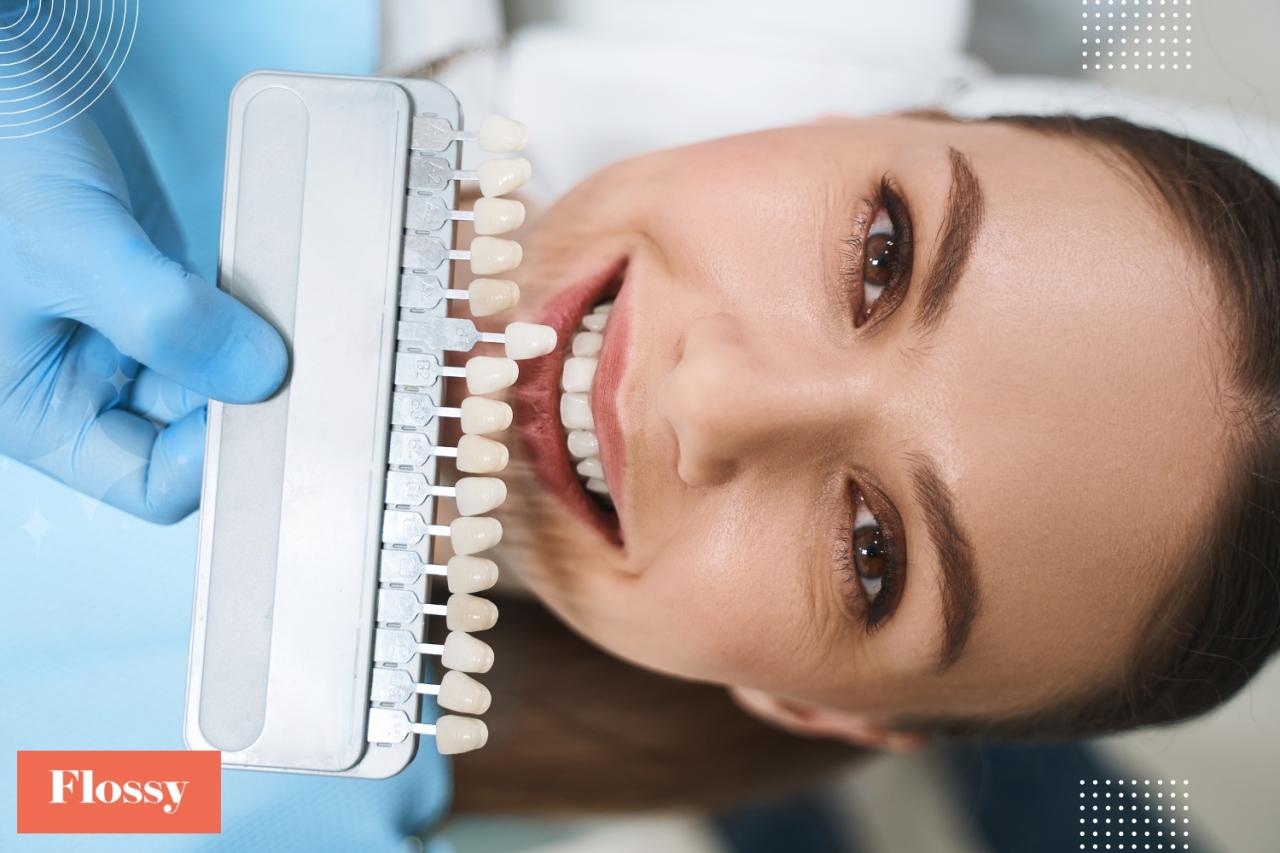 how much do veneers cost without insurance terbaru