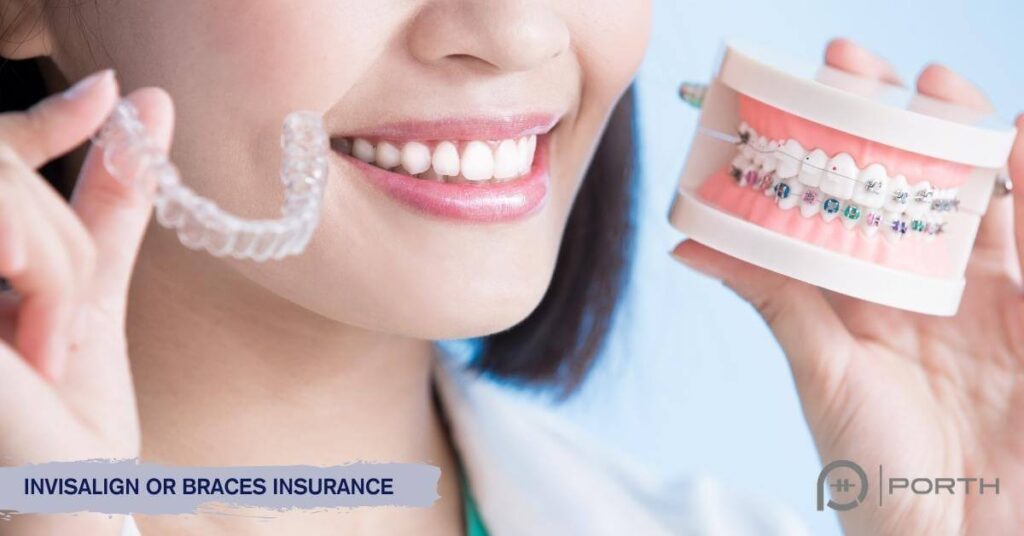 are braces covered by insurance terbaru