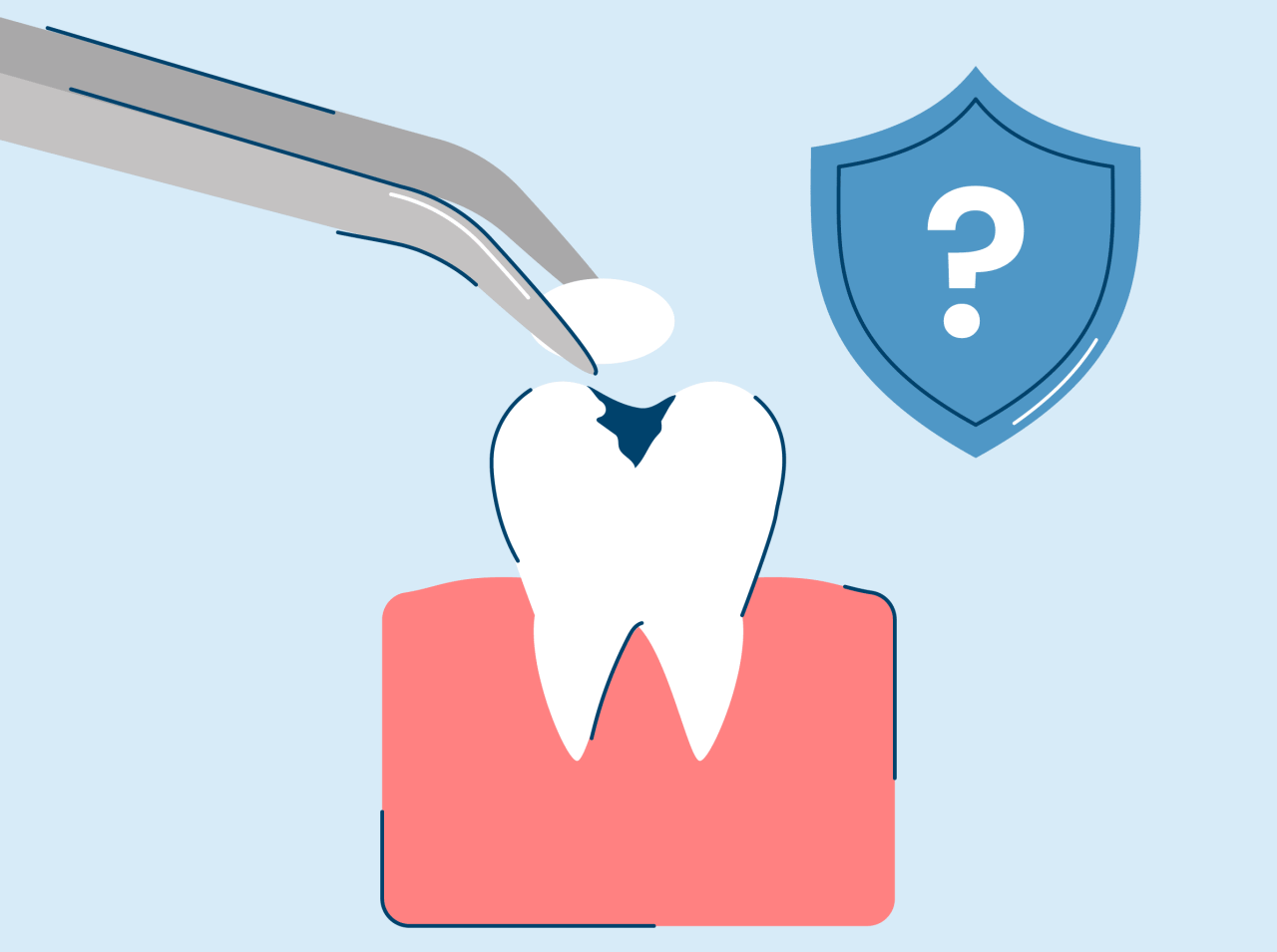 cavity filling cost without insurance terbaru