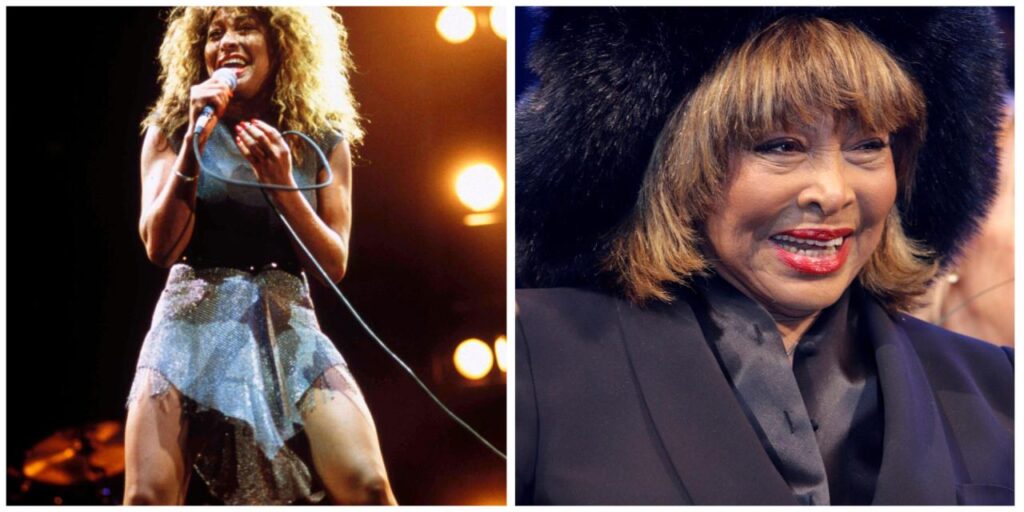 tina turner leg insurance terbaru