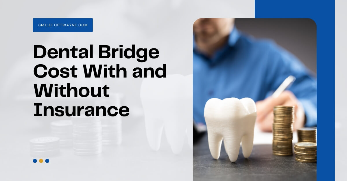 dental bridge cost without insurance terbaru