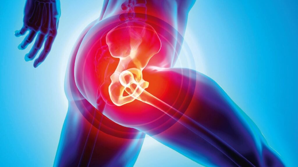 how much is hip replacement surgery with insurance