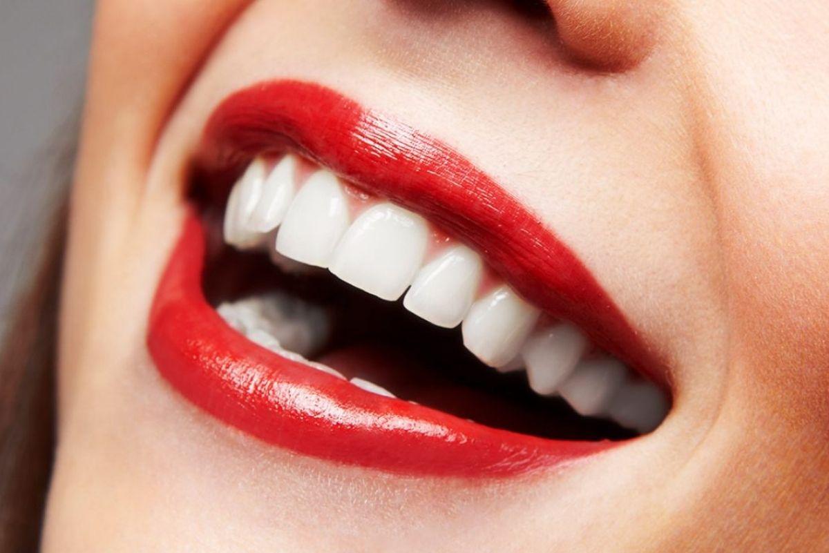 porcelain dental smile veneers veneer teeth saved cosmetic dentistry