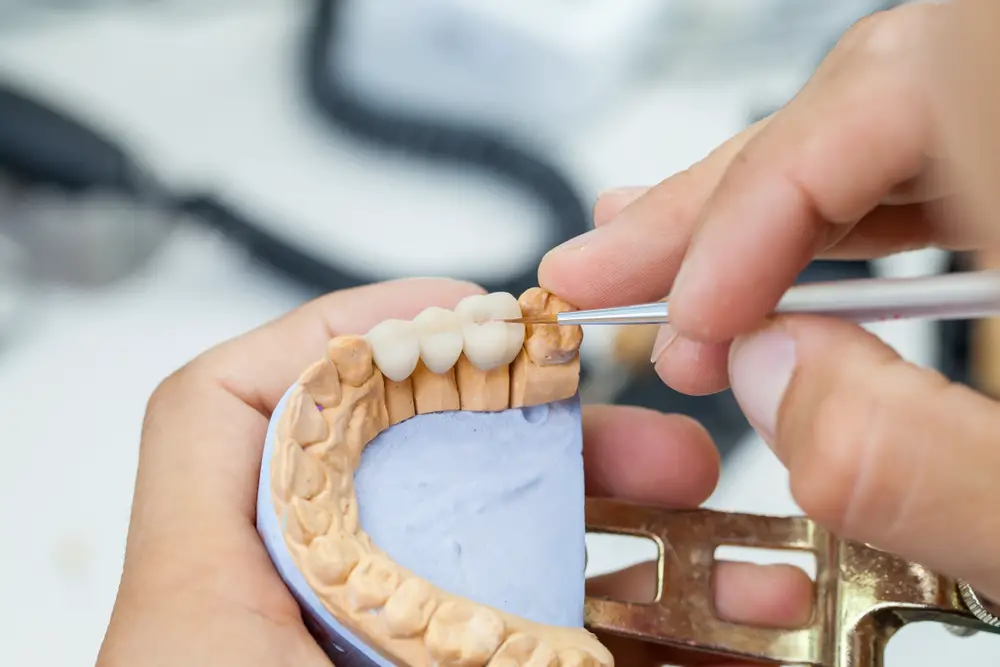 cost dental implant implants teeth vs fixed bridges crowns breakdown options bridgework full single bridge treatment tooth costs work chart