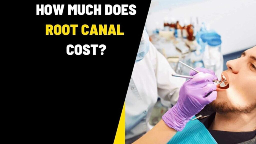 cost of root canal with insurance