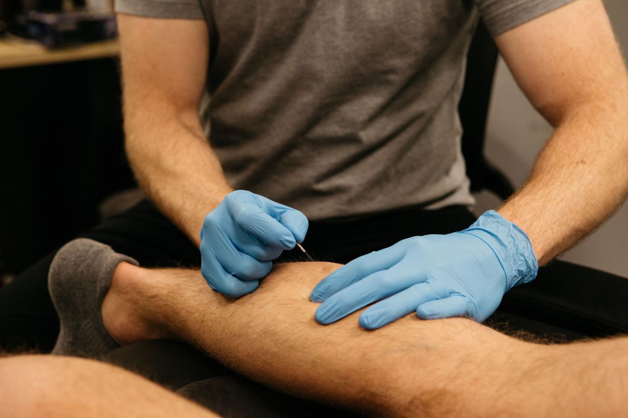 is dry needling covered by insurance terbaru