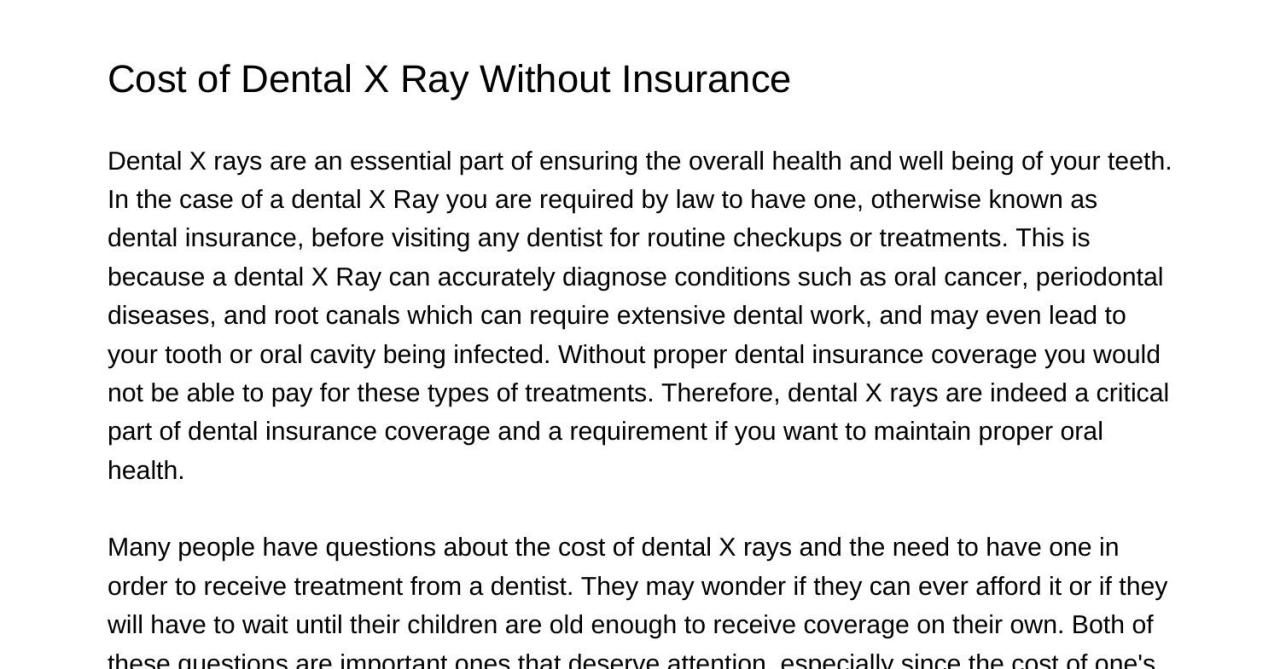cost much does ray