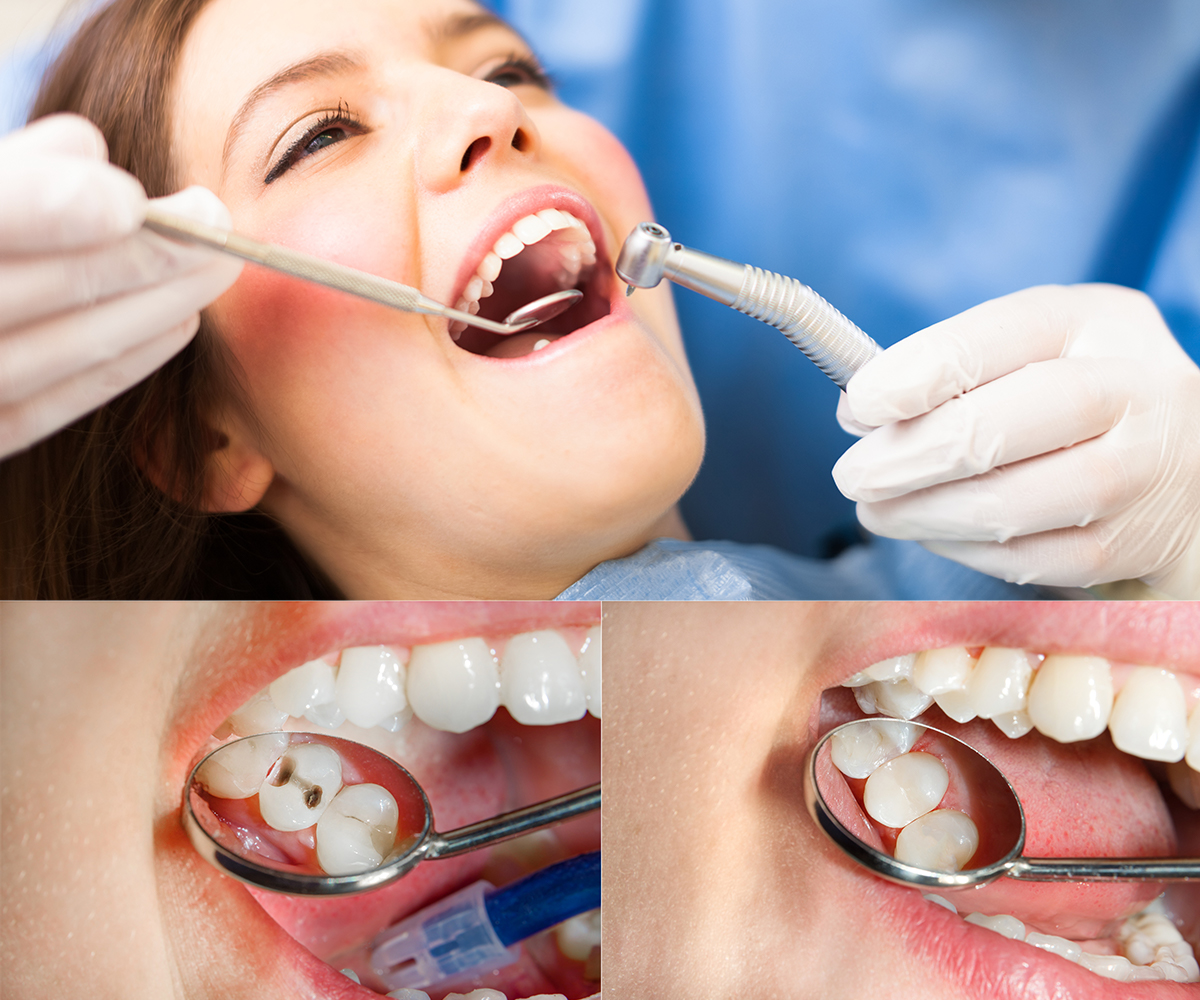 dental