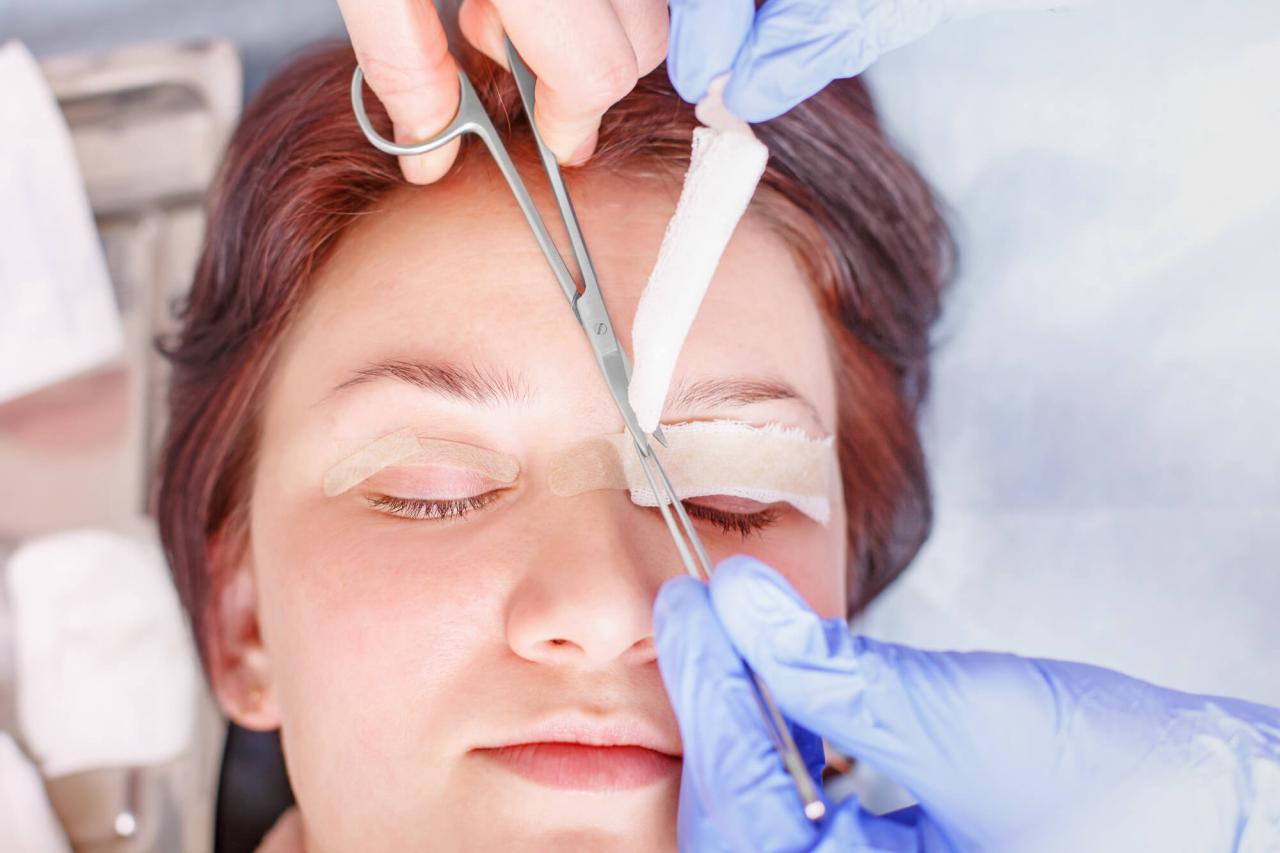is blepharoplasty surgery covered by insurance