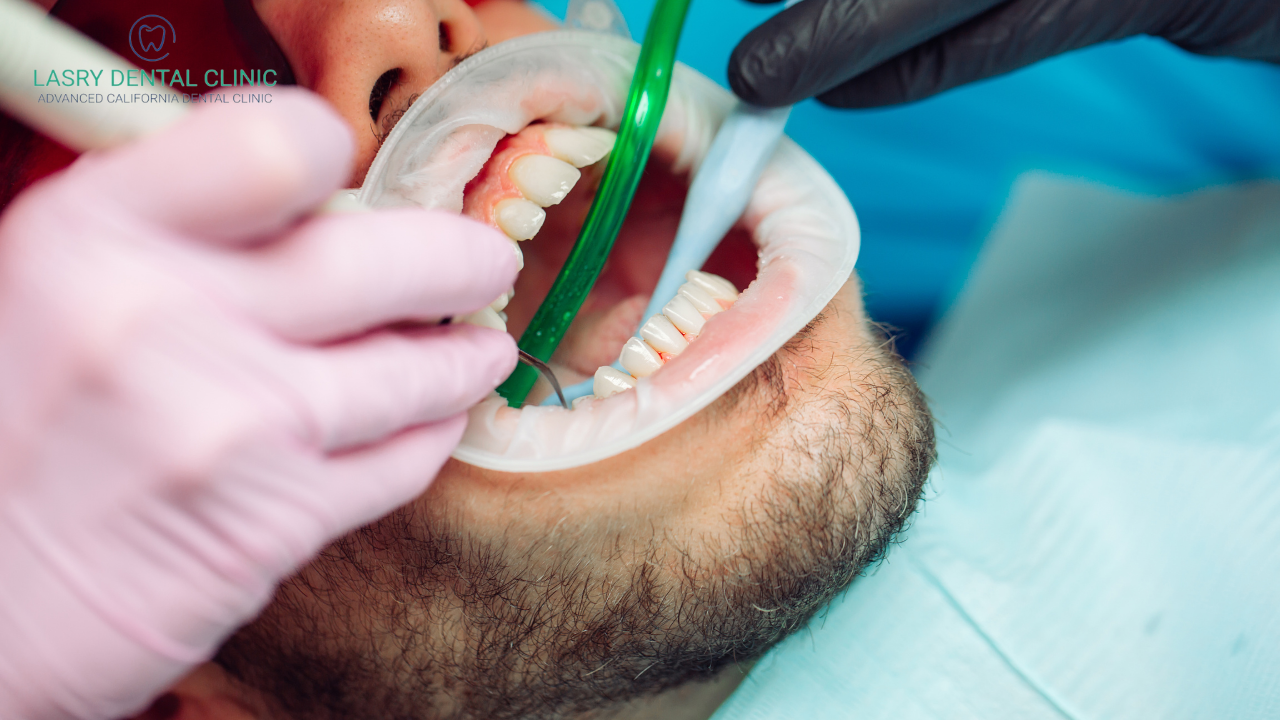 teeth cleaning without insurance cost