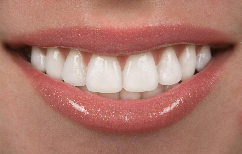 best dental insurance that covers veneers terbaru