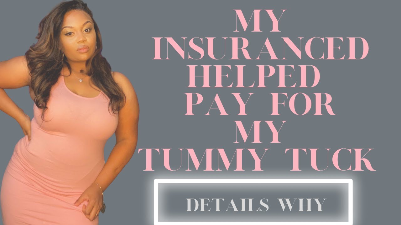 how to get a tummy tuck paid for by insurance terbaru