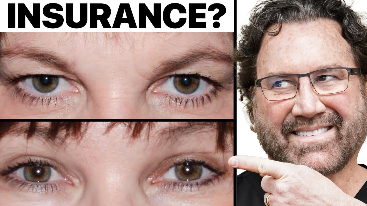 is eyelid surgery covered by insurance