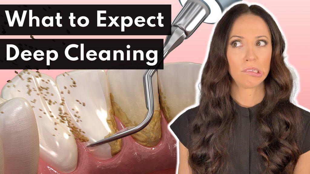 periodontal cleaning cost without insurance