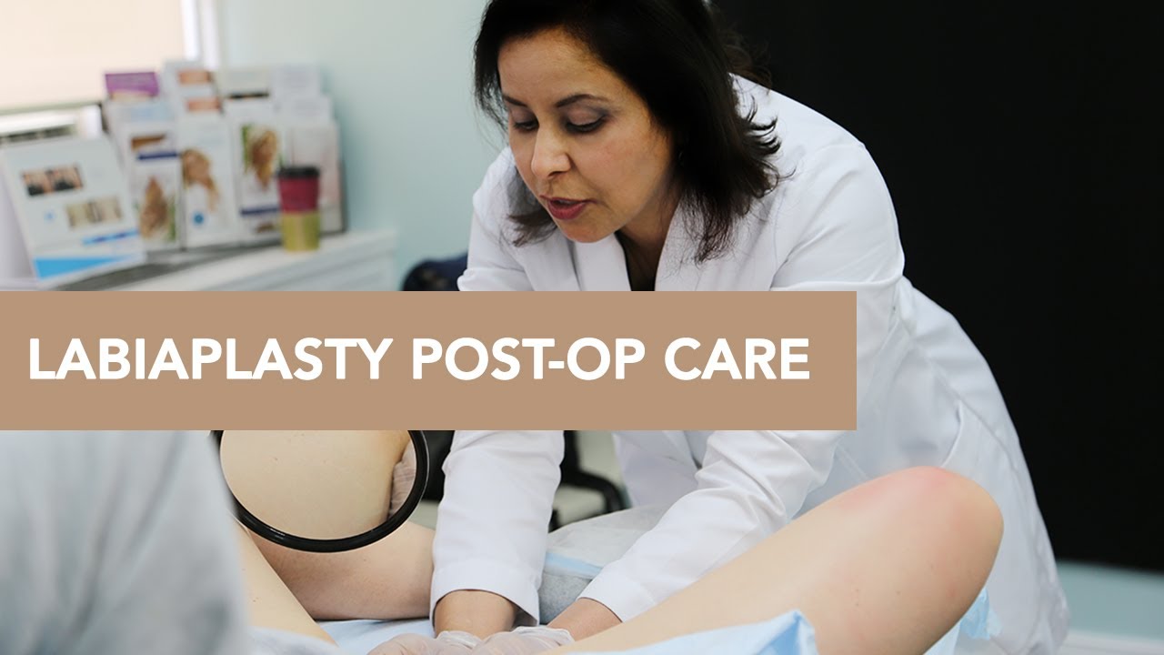 labiaplasty post surgery