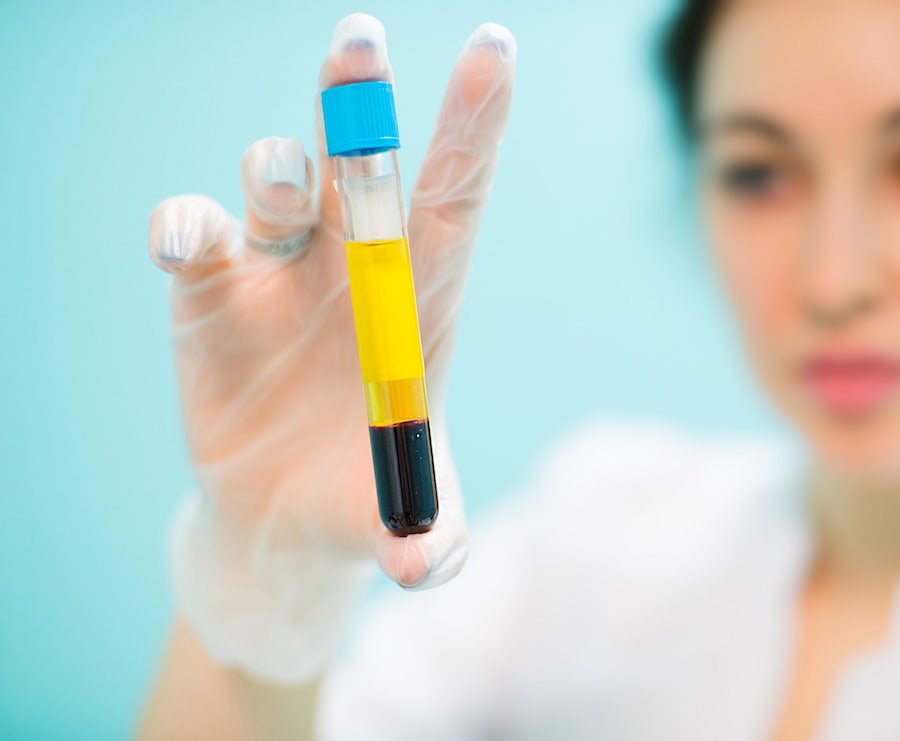 prp injection cost covered by insurance