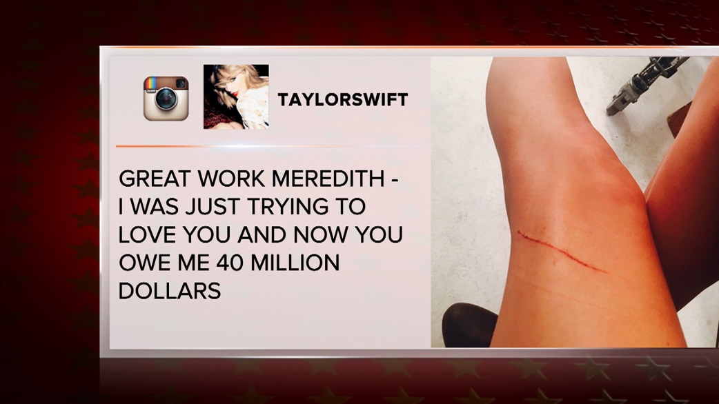taylor swift leg insurance terbaru