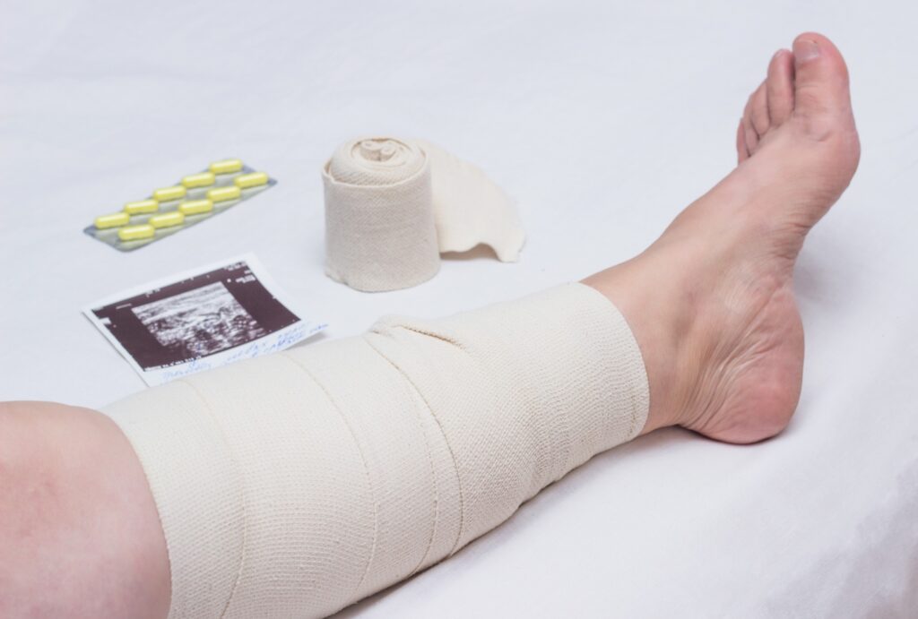 how much does varicose vein treatment cost without insurance terbaru
