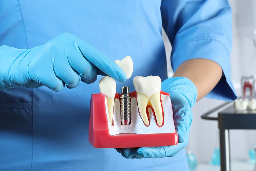 does dental insurance cover crowns