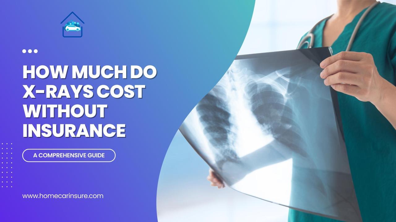 how much do x rays cost without insurance